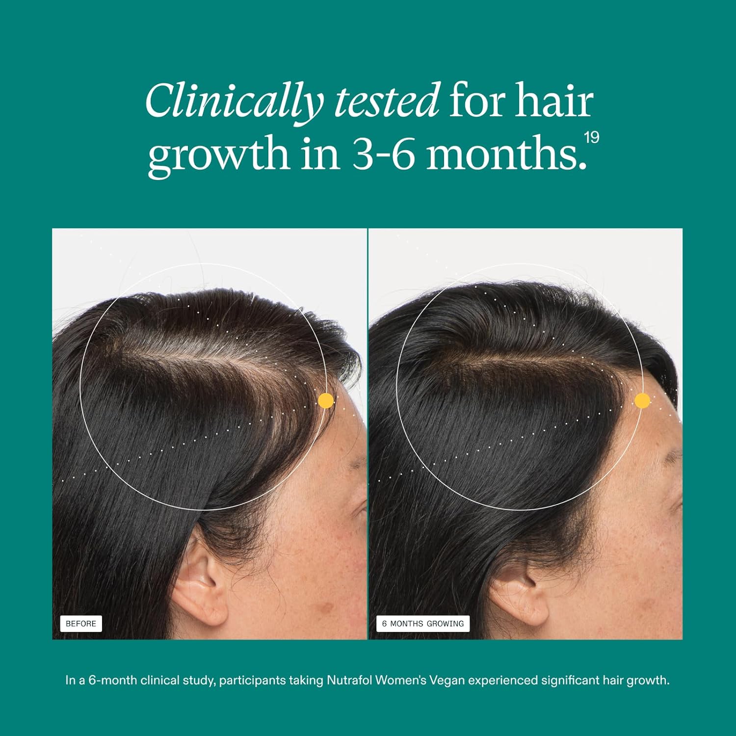 Nutrafol Hair Supplement for Women – Clinically-Tested Plant-Based Formula for Thicker, Fuller Hair– 120 Capsules - Image 4