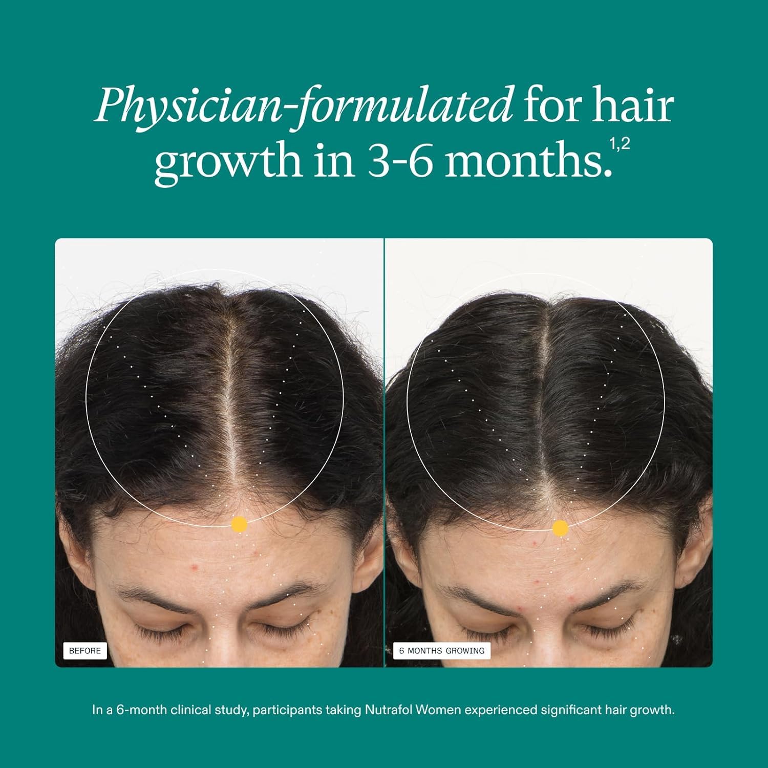 Nutrafol Women's Hair Growth Supplements, Ages 18-44, Clinically Proven for Visibly Thicker and Stronger Hair, 1 Month Supply - Image 4